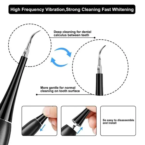 (🔥Spring Promotion 48% OFF) Electric tooth cleaning instrument -Teeth Cleaner