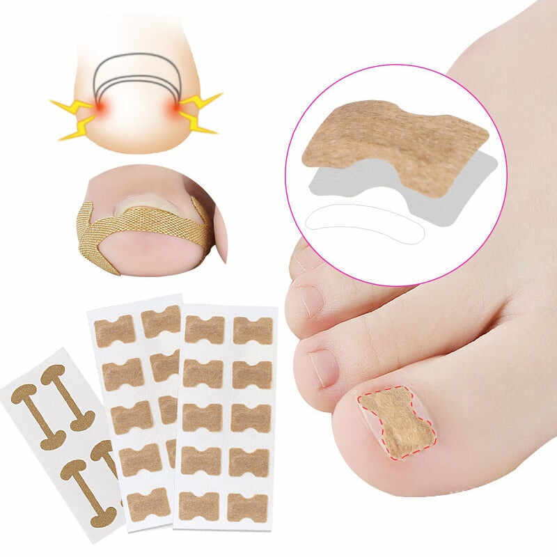 Toenail Corrector Patch