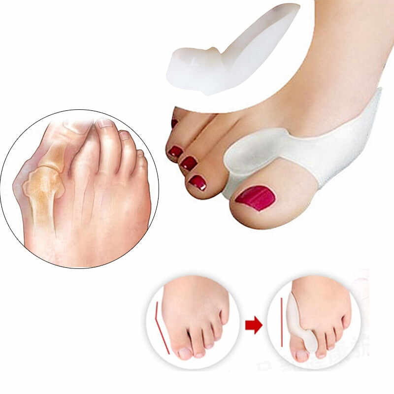 Set of 2 pairs of toe separators, hammer toe straighteners for toe overlap and toe alignment (yoga/pedicure)