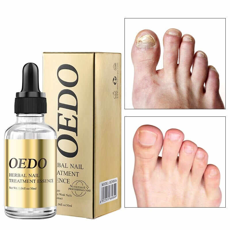 Nail Repair Essential Oil Hand and Foot