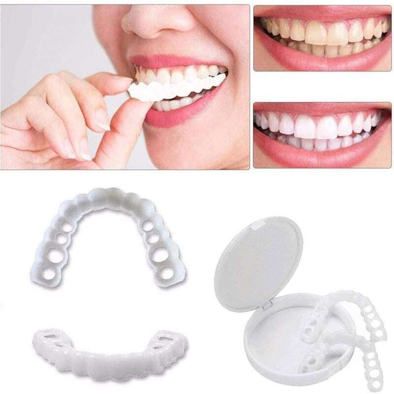 Perfect Smile Brace Snap On