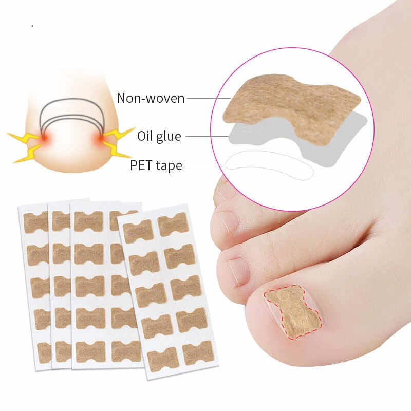 Toenail Corrector Patch