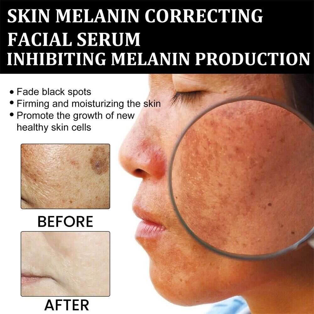 Tiworld Melanin Correcting Facial Serum