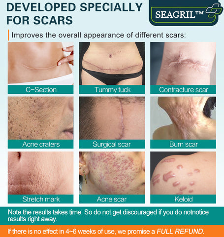 Scar Removal Spray