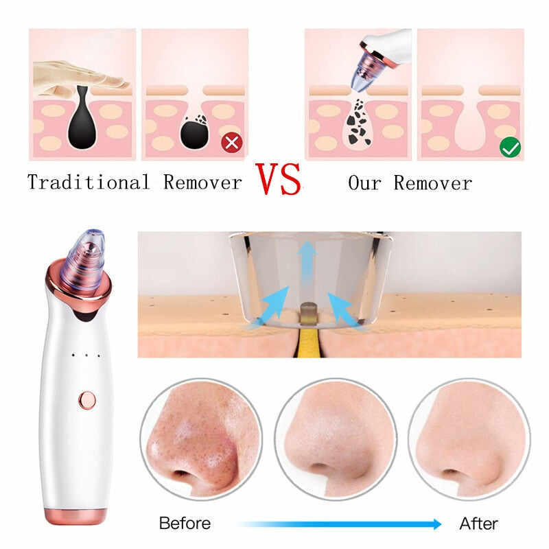 Newest Blackhead Remover Pore Vacuum Electric Pore Cleaner