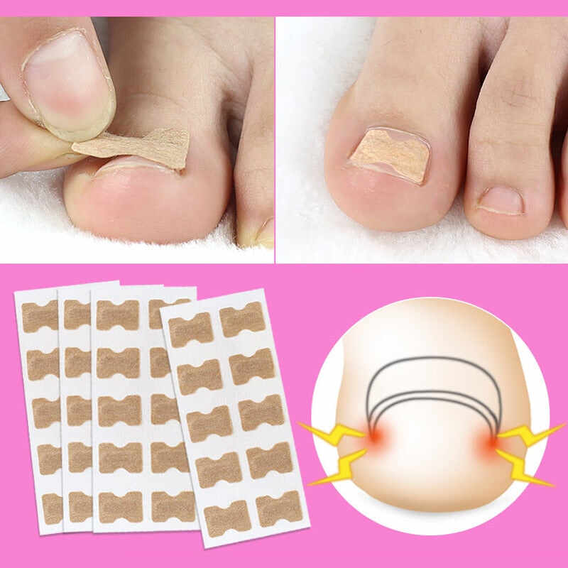 Toenail Corrector Patch