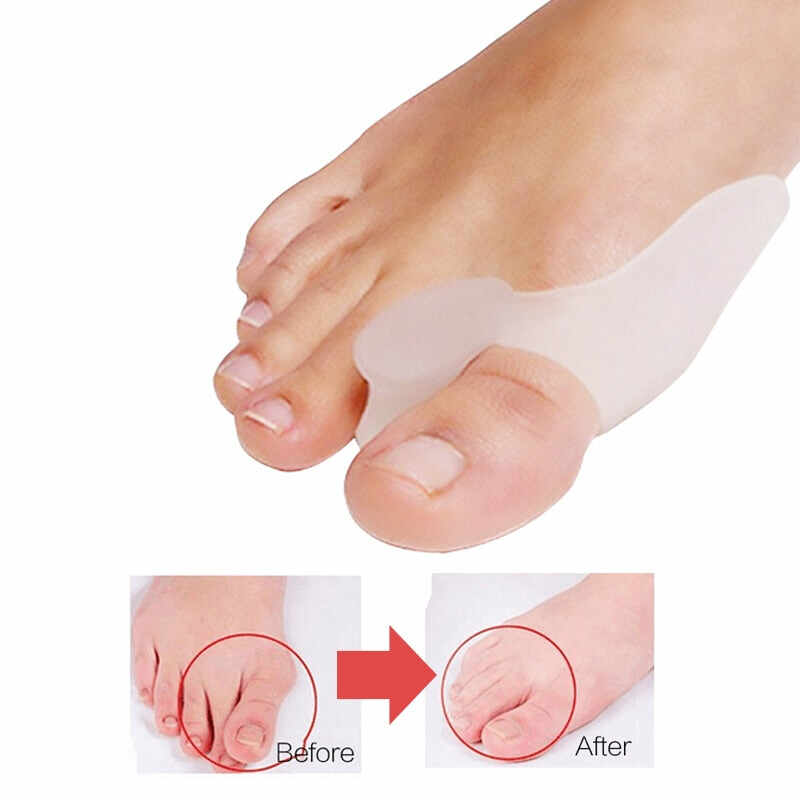 Set of 2 pairs of toe separators, hammer toe straighteners for toe overlap and toe alignment (yoga/pedicure)