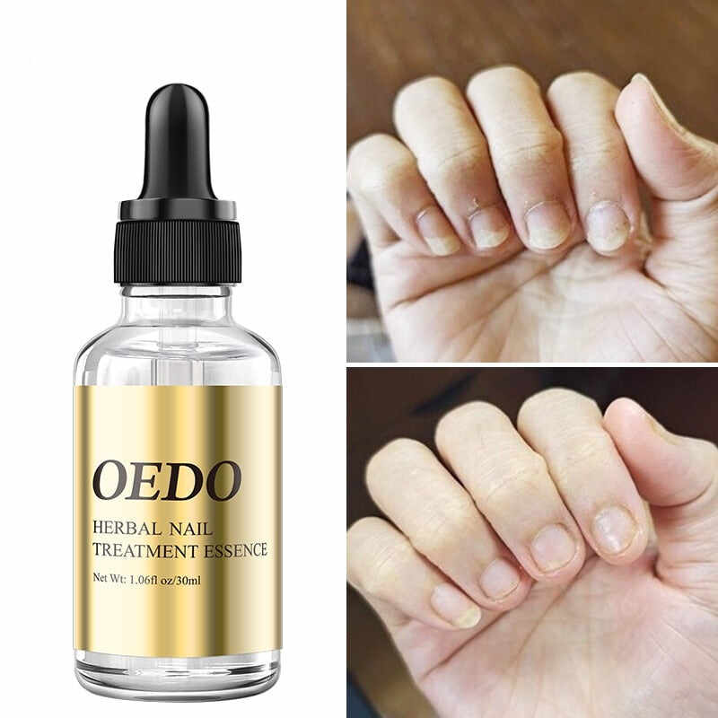 Nail Repair Essential Oil Hand and Foot