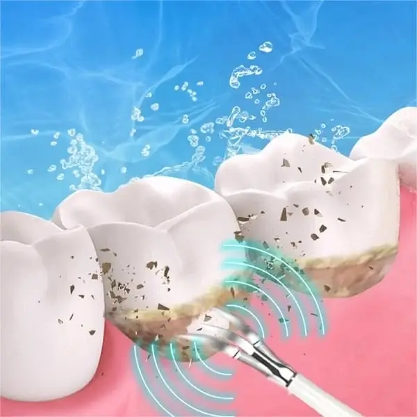 (🔥Spring Promotion 48% OFF) Electric tooth cleaning instrument -Teeth Cleaner