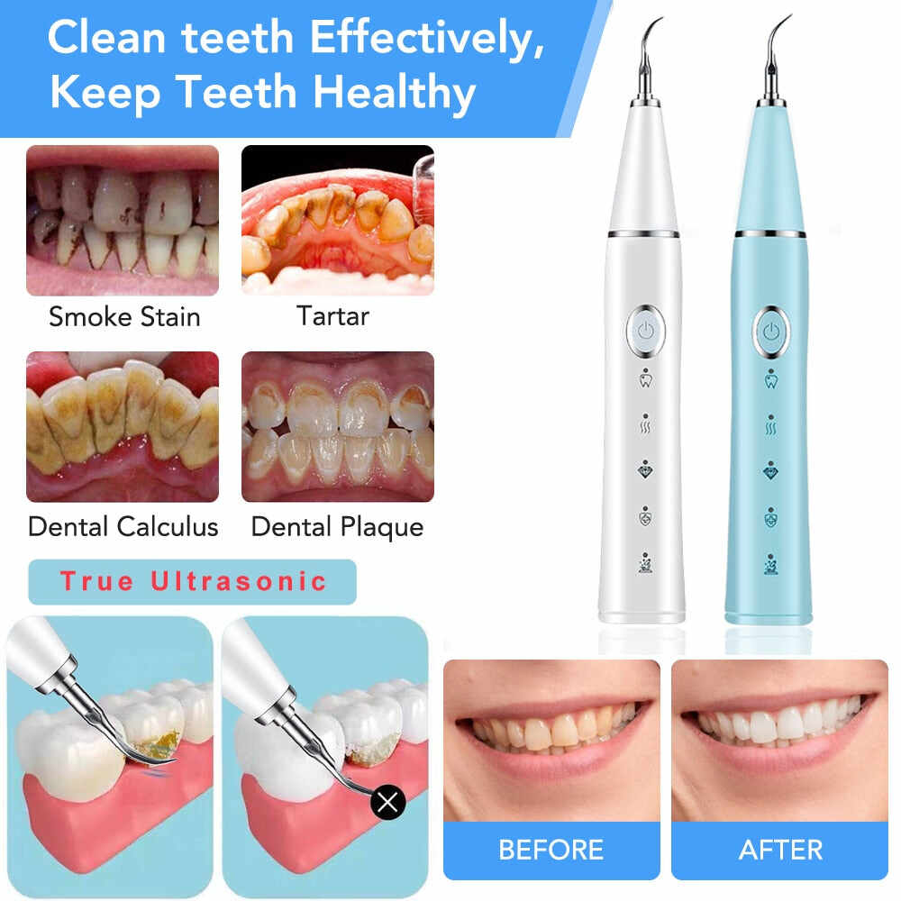 Plaque Remover for Teeth,